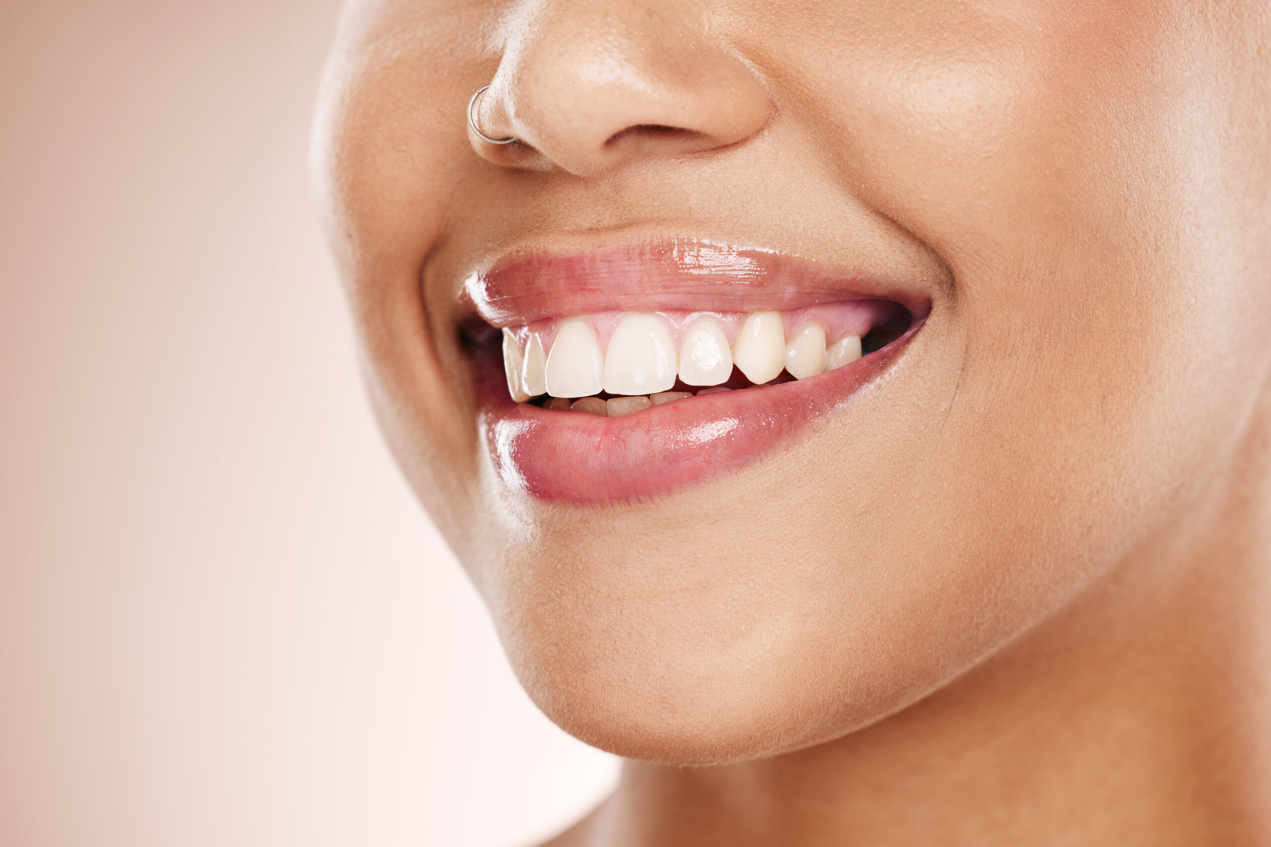 Woman smiling to show bright white teeth after cosmetic dental treatment in Peoria, AZ.